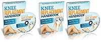 Knee Replacement Handbook